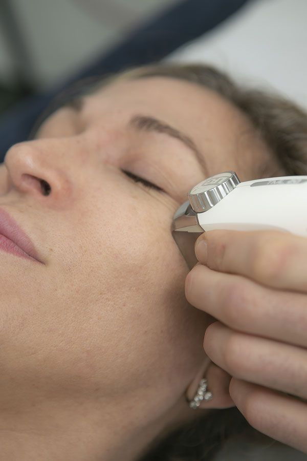 Soin d’endermologie LPG du visage